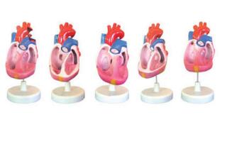 先天性心脏畸形模型 型号：SJ/116016