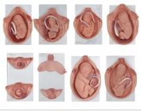 胎儿妊娠胚胎发育模型 型号：SJ/142007-2
